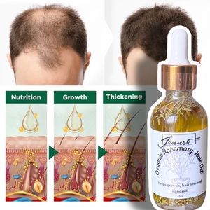 100% natural oil for hair growth and combats hair loss